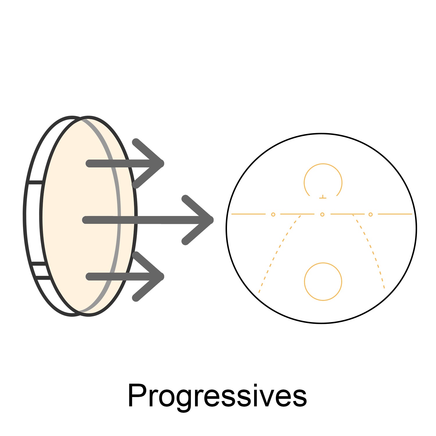 Progressives